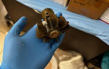 Медики достали хвостовик мины из тела военного: на операцию вызвали саперов (фото)