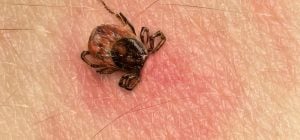 Вкусив кліщ - ось що потрібно зробити в першу чергу: діяти треба негайно