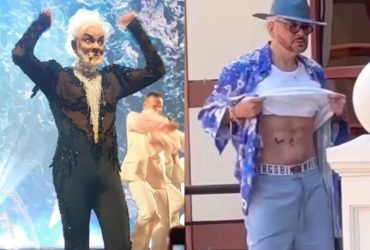 Жир відкачав - найгарнішим не став: хірург розкрив проблему порізаного Кіркорова