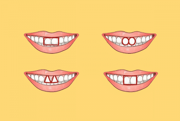 Интересный экспресс-тест: как определить характер по зубам