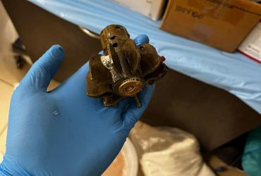 Медики достали хвостовик мины из тела военного: на операцию вызвали саперов (фото)