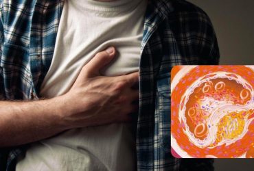 Названо три продукти на сніданок, які допоможуть знизити рівень холестерину