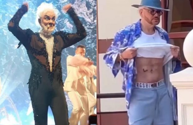 Жир відкачав - найгарнішим не став: хірург розкрив проблему порізаного Кіркорова