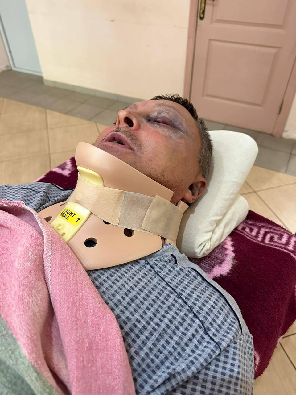 На Одещині жорстоко побили військовослужбовця: чоловік у лікарні (відео) На Одещині жорстоко побили військовослужбовця: чоловік у лікарні (відео)