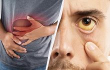 В Виннице - эпидемия гепатита А: основные симптомы, лечение и профилактика
