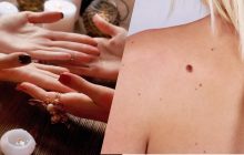 Расскажет всё о вашей судьбе: что значит каждая родинка на лице и на теле