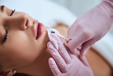 Цього не розповість косметолог: що не можна робити після збільшення губ