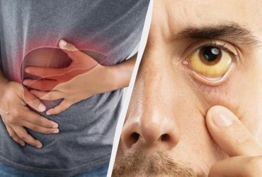 В Виннице - эпидемия гепатита А: основные симптомы, лечение и профилактика