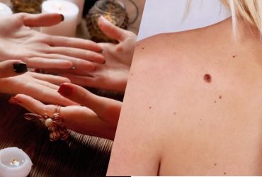 Розповість все про вашу долю: що значить кожна родимка на обличчі і на тілі