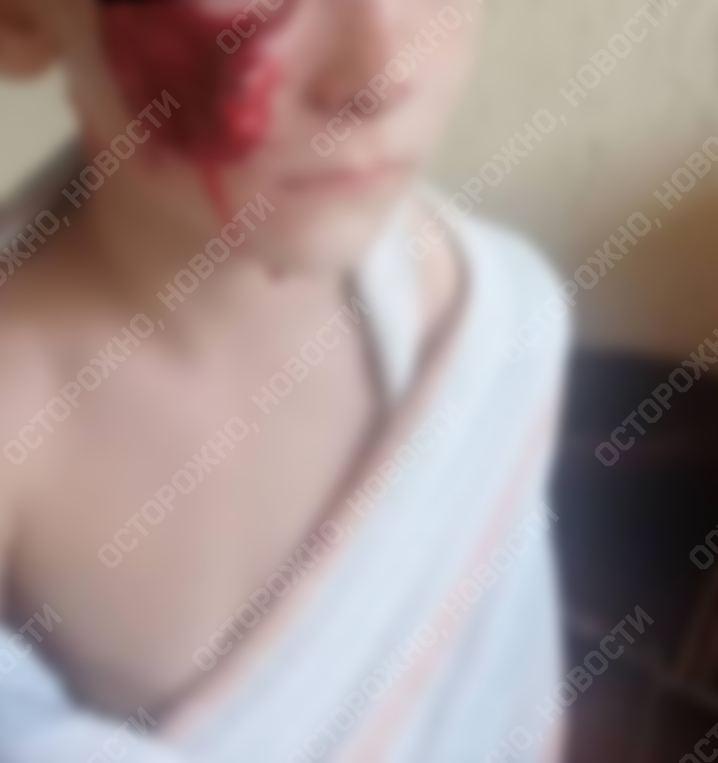 В РФ собака депутата-'єдинороса' жорстоко покалічив дитину В РФ собака депутата-'єдинороса' жорстоко покалічив дитину