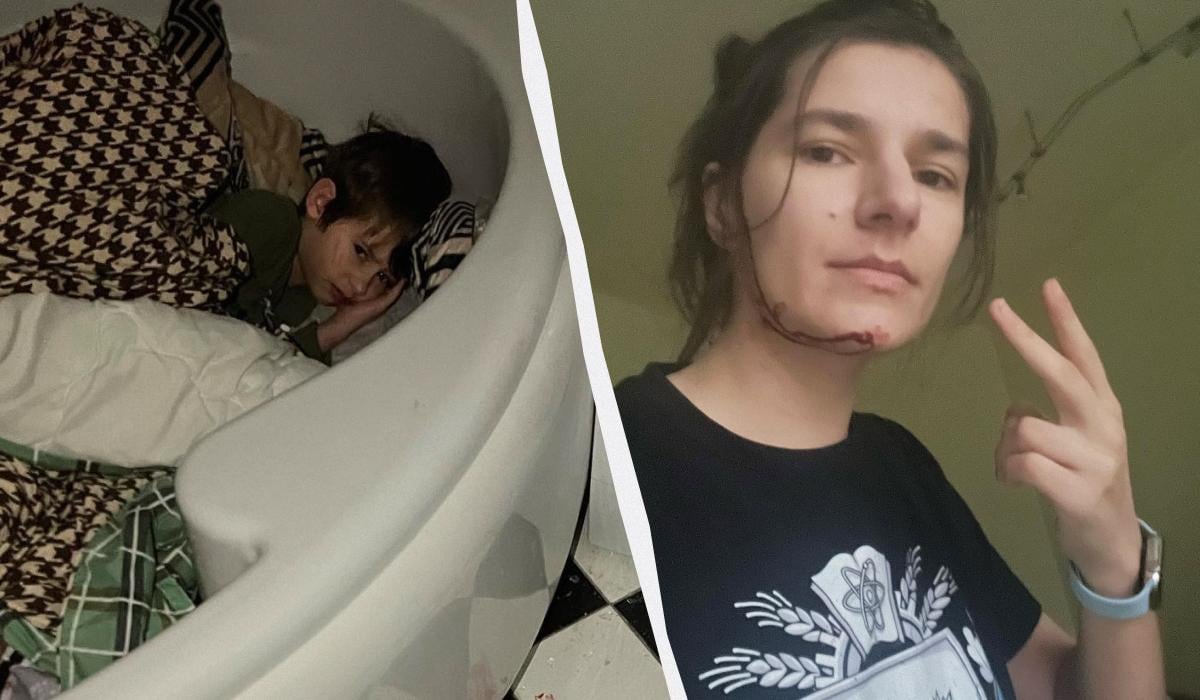 Волонтеру стеклом порезало лицо / коллаж УНИАН, фото Facebook /popova.natali Волонтеру стеклом порезало лицо / коллаж УНИАН, фото Facebook /popova.natali