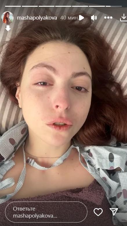 Маші зробили операцію / скріншот Instagram Маші зробили операцію / скріншот Instagram