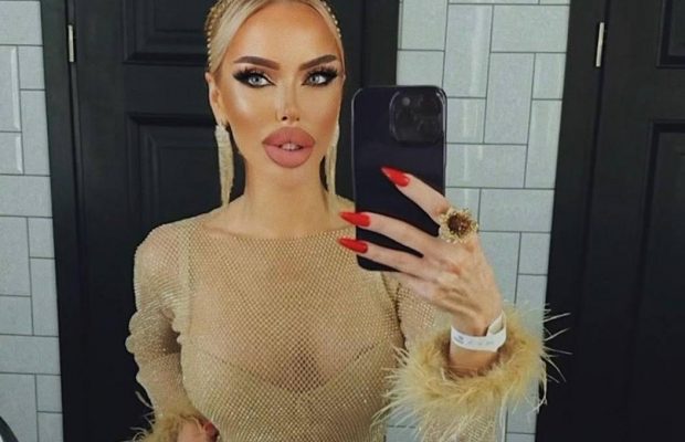 Який вигляд мала "міс ДНР" Андрієвська до пластики: зовсім інша людина (фото)