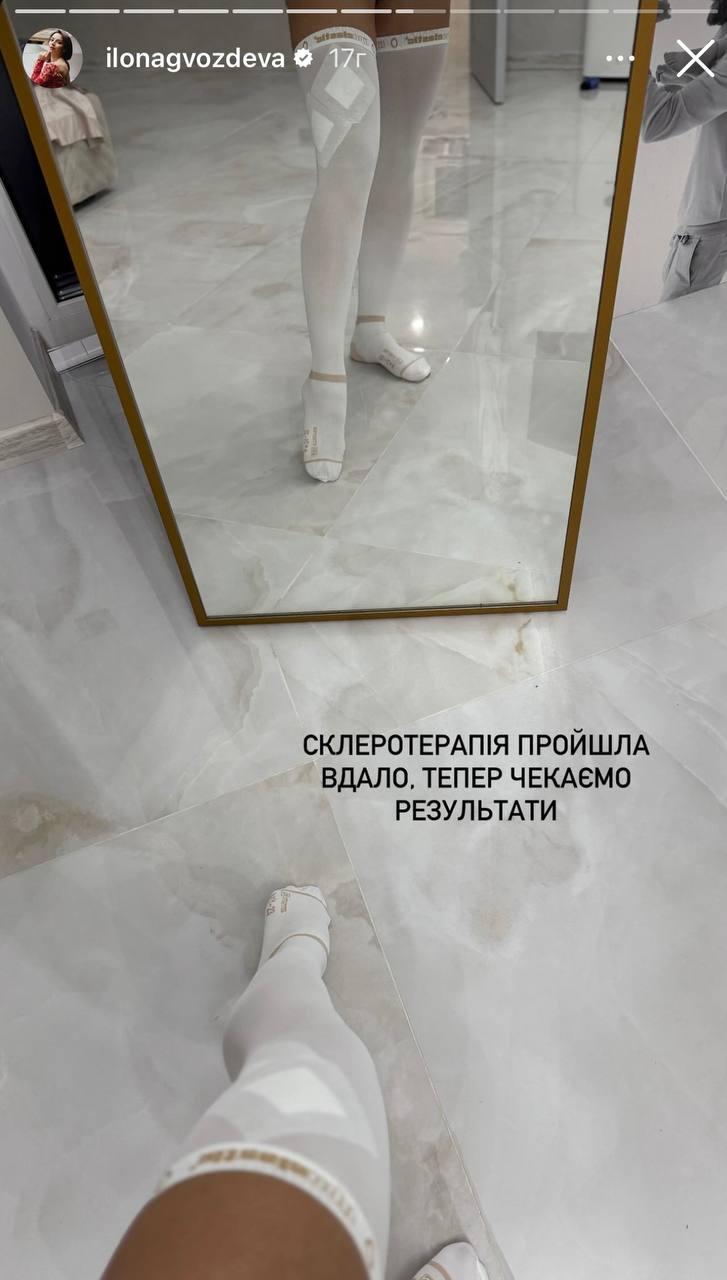Скріншот сторіз Ілони Скріншот сторіз Ілони