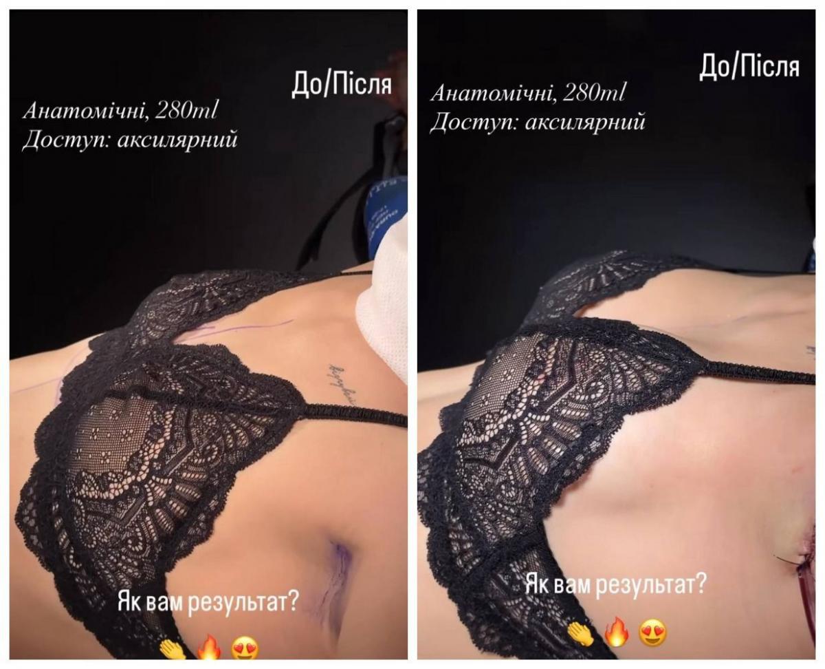 Скріншот Instagram Скріншот Instagram