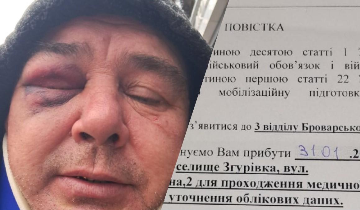 На Київщині 55-річного водія побили після того, як його машину зупинили представники ТЦК / Колаж УНІАН, фото Вероніка Кольцова Facebook На Київщині 55-річного водія побили після того, як його машину зупинили представники ТЦК / Колаж УНІАН, фото Вероніка Кольцова Facebook