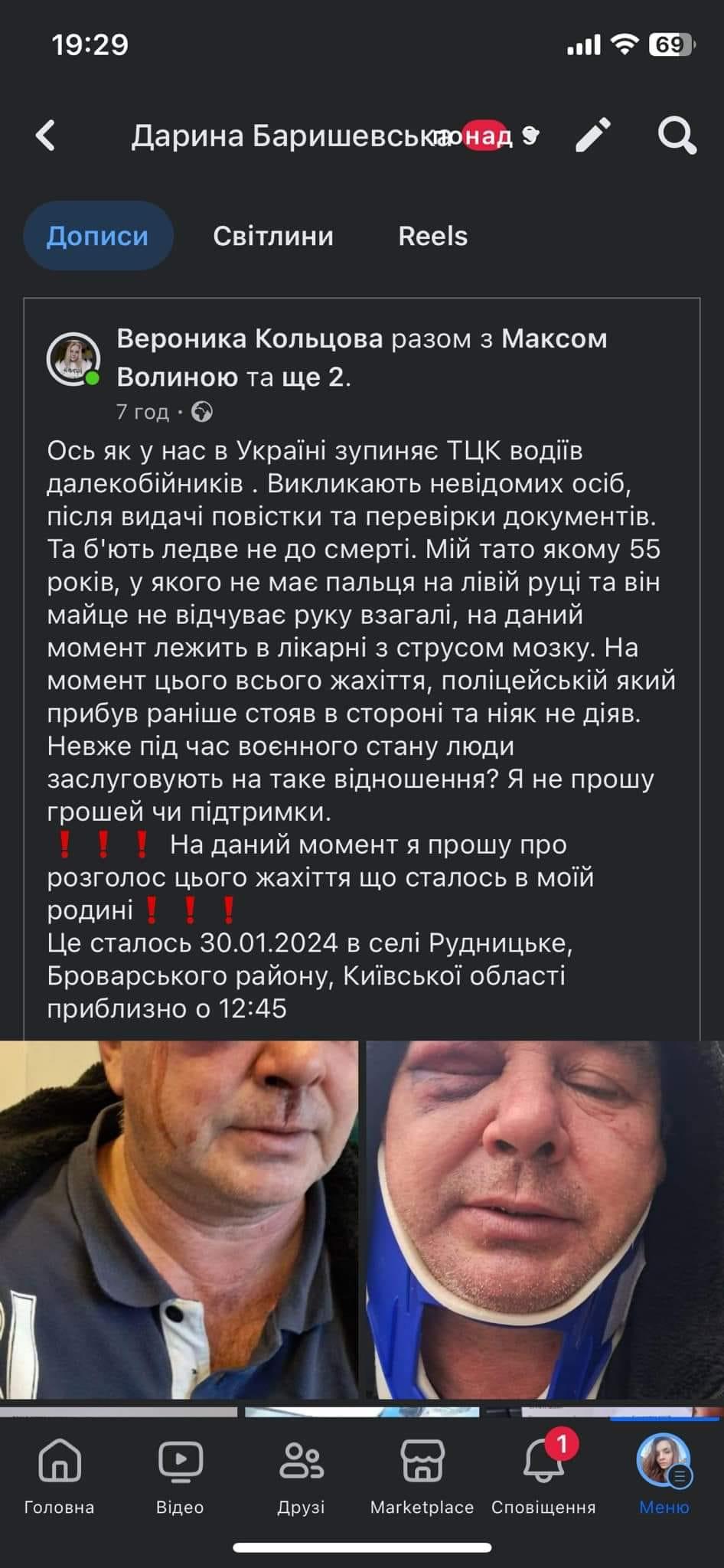 Історія про побиття водія у селі Рудницьке від його доньки / фото Вероніка Кольцова Facebook Історія про побиття водія у селі Рудницьке від його доньки / фото Вероніка Кольцова Facebook