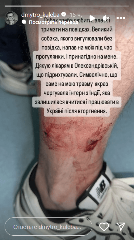 На главу МИД Кулебу напала собака и разорвала ногу (фото) На главу МИД Кулебу напала собака и разорвала ногу (фото)