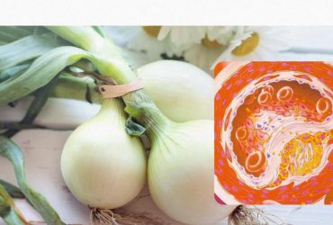 Ученые назвали овощ, который жизненно необходим людям с высоким уровнем холестерина