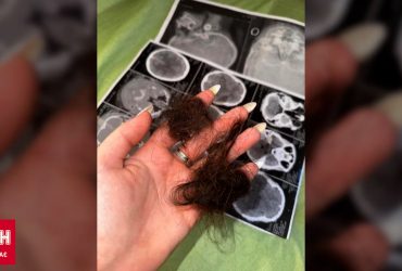 Скандал на Прикарпатье: женщину и 6-летнего ребенка избили битой из-за подозрения в сотрудничестве с ТЦК