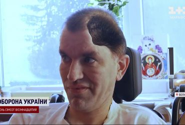 Заново вчився дихати, ковтати і рухатися: історія кулеметника, в порятунок якого ніхто не вірив