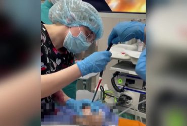 Врачи спасли мальчика, который проглотил 20 магнитов