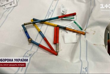 В Охматдете спасли мальчика, который проглотил сразу 20 магнитов