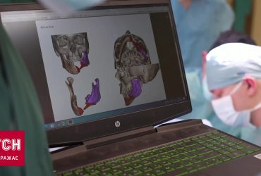 Львівські медики перевершили себе: операція на межі фантастики