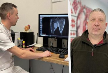 Львів’янину видалили зі стегна пухлину розміром з м’яч для регбі (фото)