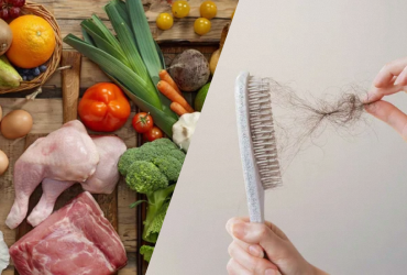 Врач назвал продукты, из-за которых выпадают волосы: 99% людей едят это каждый день