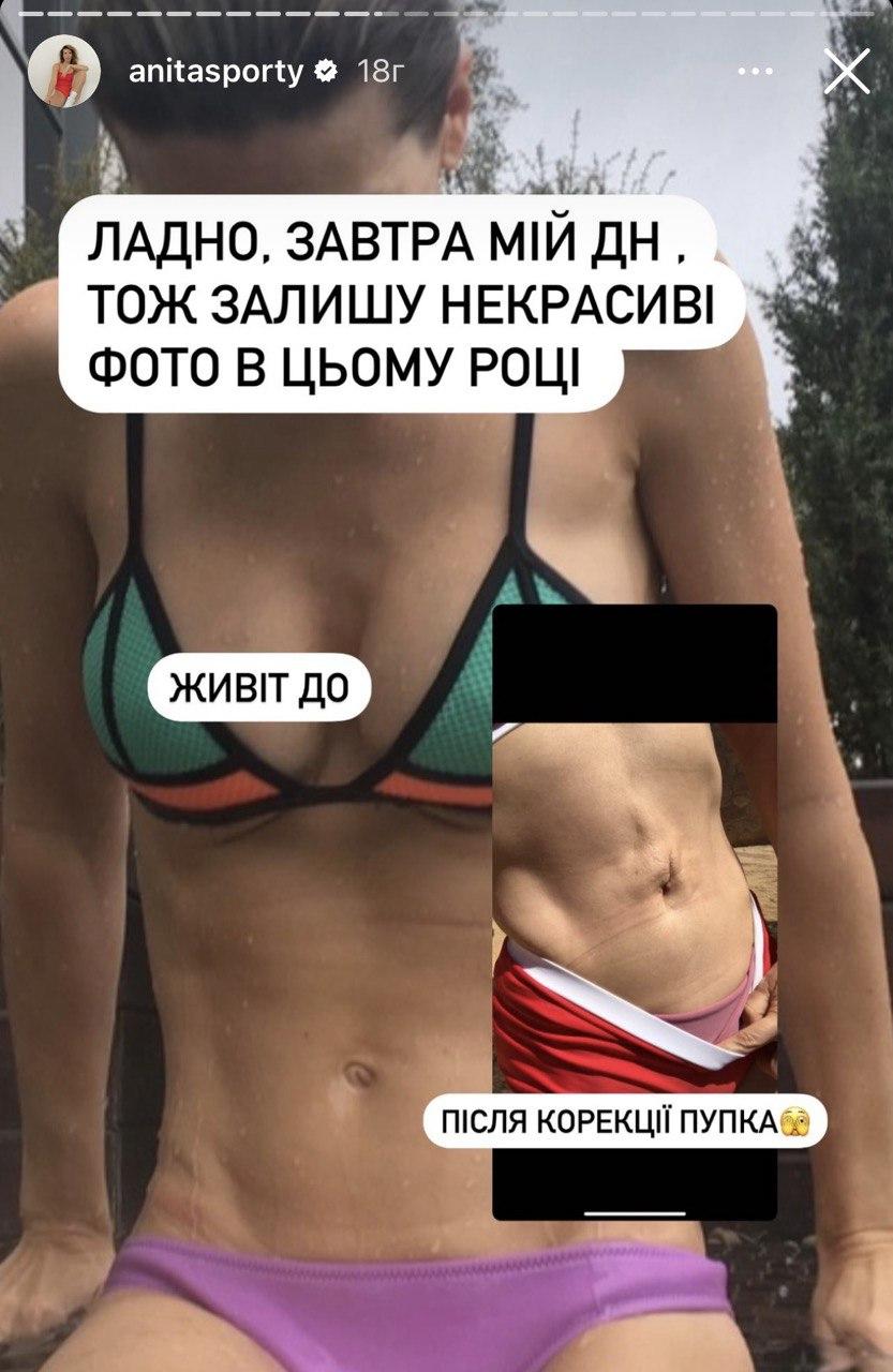 Скриншот сторис Аниты Скриншот сторис Аниты