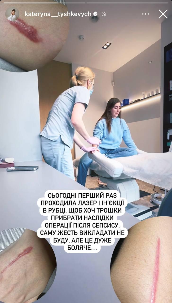 Скріншот сторіз Катерини Тишкевич Скріншот сторіз Катерини Тишкевич