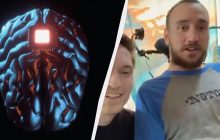 В компанії Ілона Маска показали першу людину, якій вживили чип у мозок (відео)