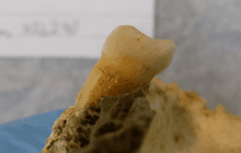 У зубах людини, останкам якої 4000 років, виявили бактерії, що викликають карієс