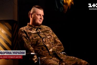 Заплакал, когда жене рассказали, что он потерял руки: а он просил протезы, чтобы обнимать детей