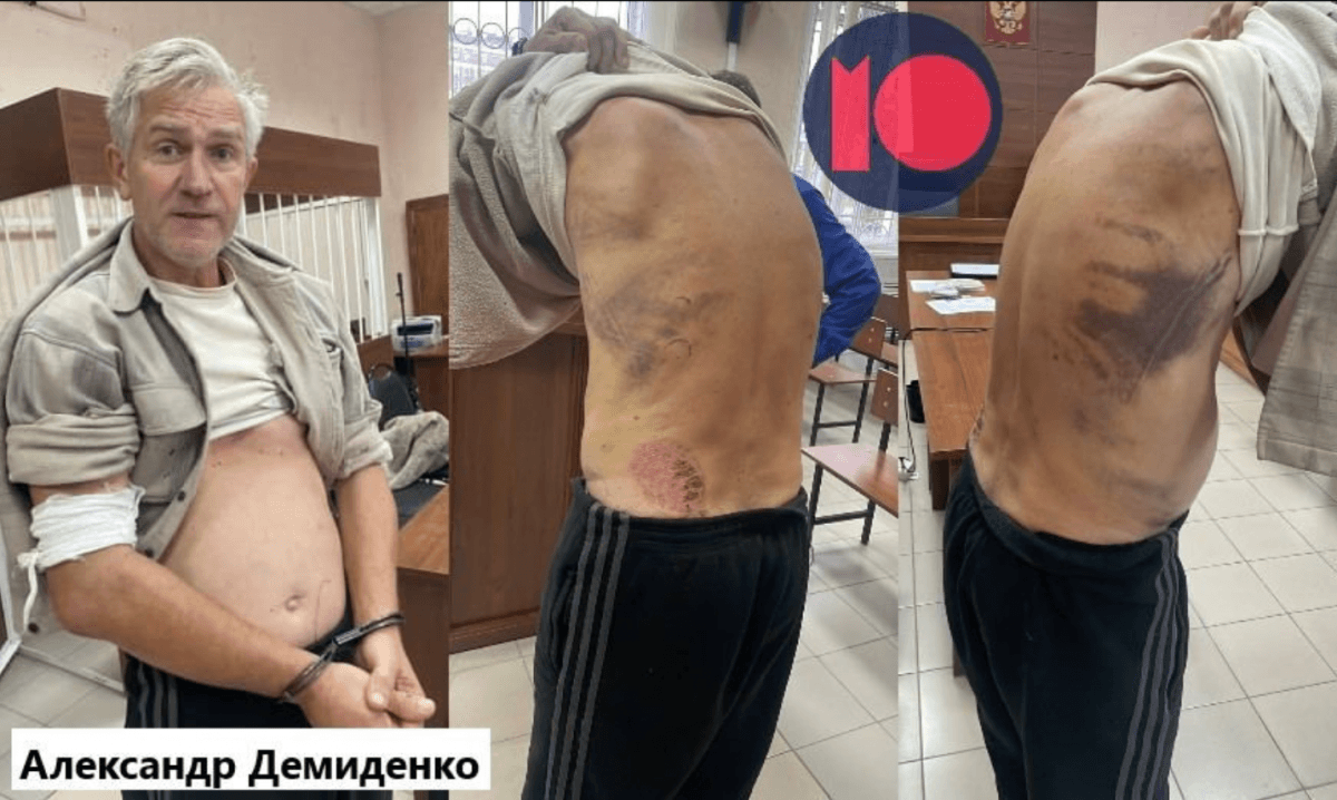 Помогал украинцам: в российском СИЗО умер пожилой волонтер Помогал украинцам: в российском СИЗО умер пожилой волонтер