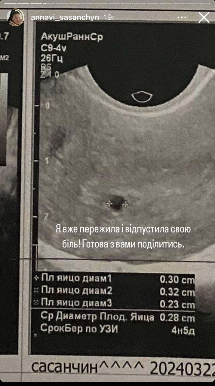 Скріншот сторіз Іванни Скріншот сторіз Іванни