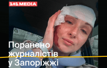 Корреспондент ТСН получила ранения при обстреле оккупантами Запорожья (фото)