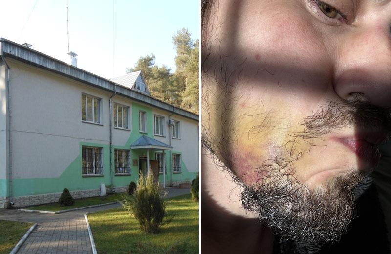 Мене катують та вимагають гроші - бізнесмен-біженець став заручником у Волинському ПТПІ Мене катують та вимагають гроші - бізнесмен-біженець став заручником у Волинському ПТПІ