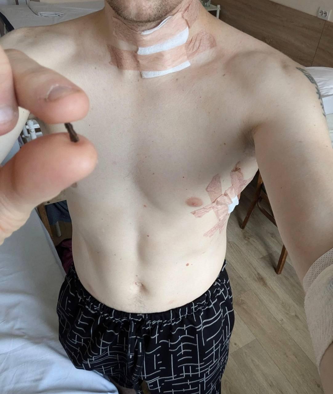 Раненный Станислав Асеев / фото фейсбук Станислава Асеева Раненный Станислав Асеев / фото фейсбук Станислава Асеева
