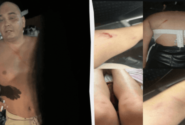 В РФ герой СВО жестоко избил двух женщин костылем (видео)