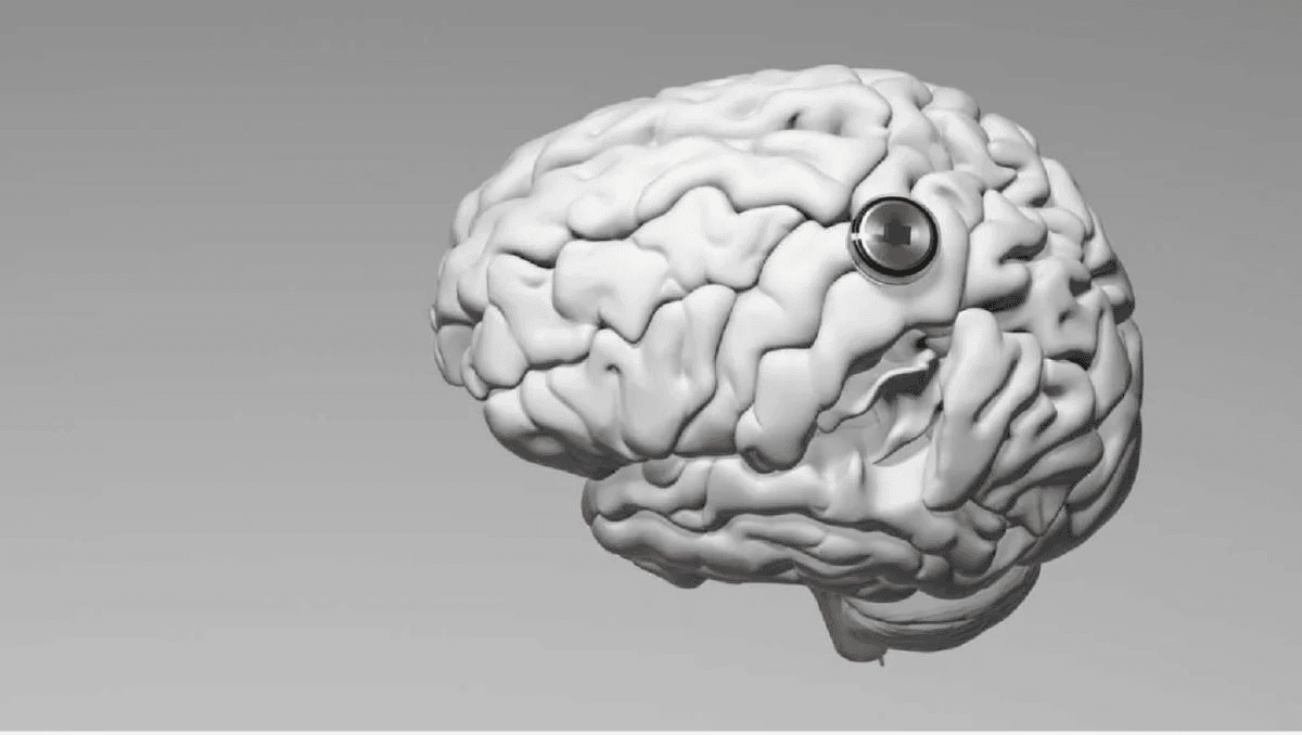 Ілон Маск оголосив про успішну імплантацію чіпа Neuralink другому пацієнту / фото Neuralink Ілон Маск оголосив про успішну імплантацію чіпа Neuralink другому пацієнту / фото Neuralink