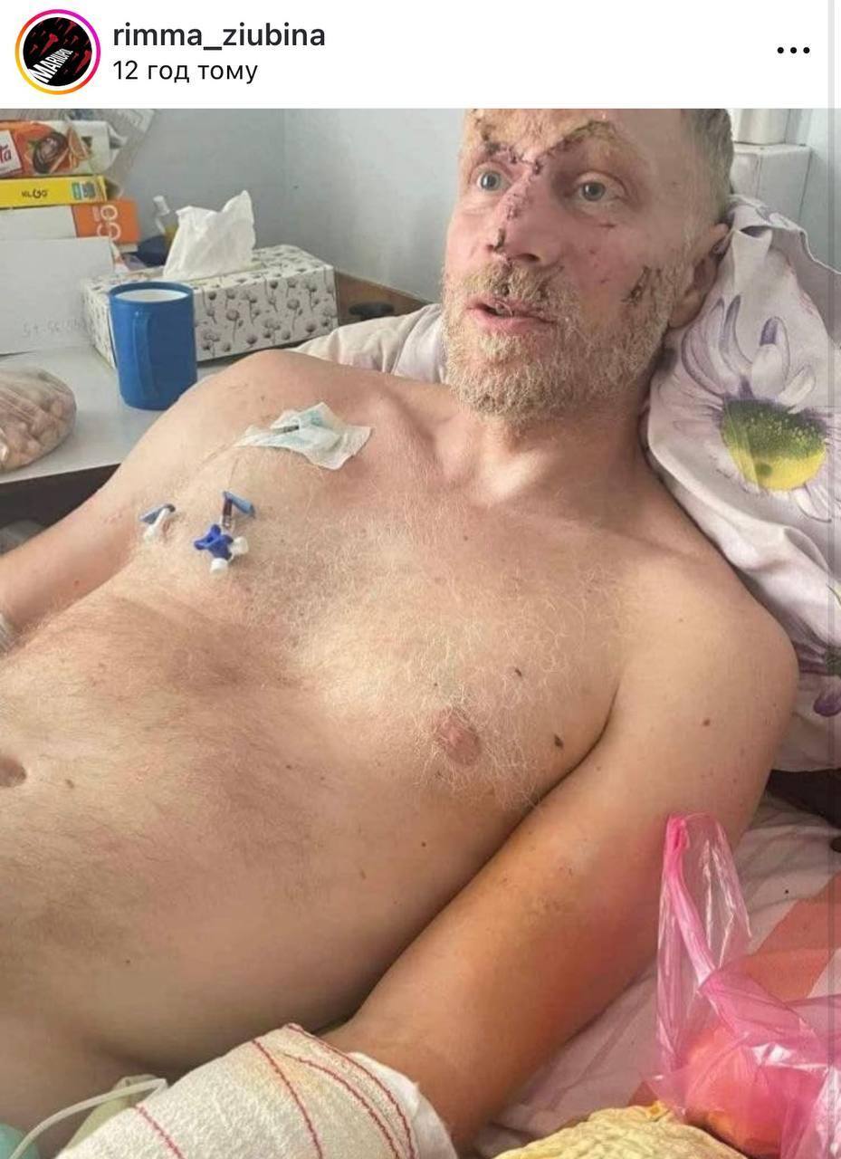 Раненый Андрей Валенский / фото инстаграм Риммы Зюбиной Раненый Андрей Валенский / фото инстаграм Риммы Зюбиной