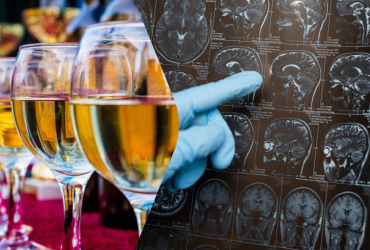 Експерти назвали вік, коли не варто пити алкоголь, аби знизити ризик розвитку деменції