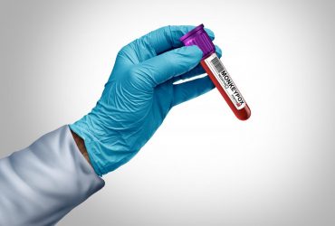 В Европе выявлен первый случай заражения оспой обезьян: что известно