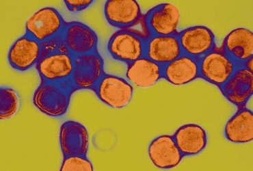 Новий штам віспи змінюється швидше, ніж очікувалося: чим це загрожує