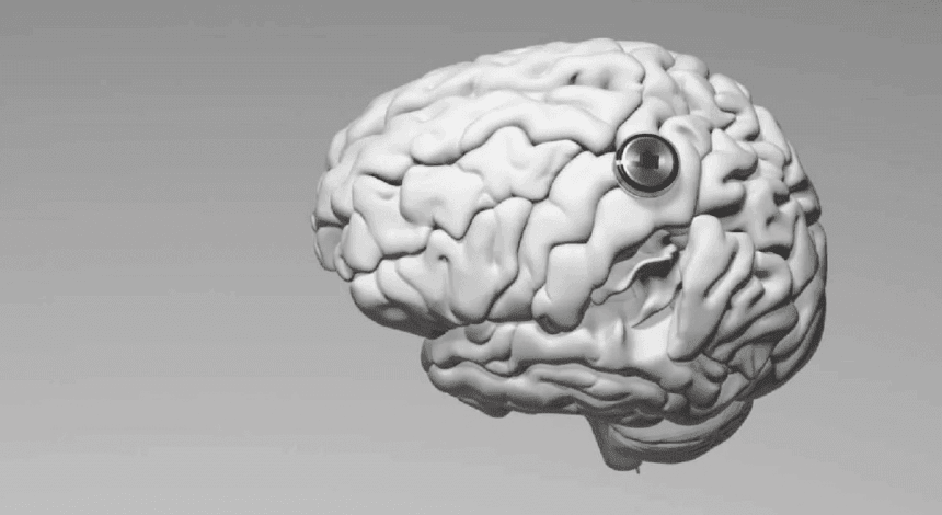 Neuralink показала, как второй пациент с мозговым чипом играет в CS2 "силой мысли"