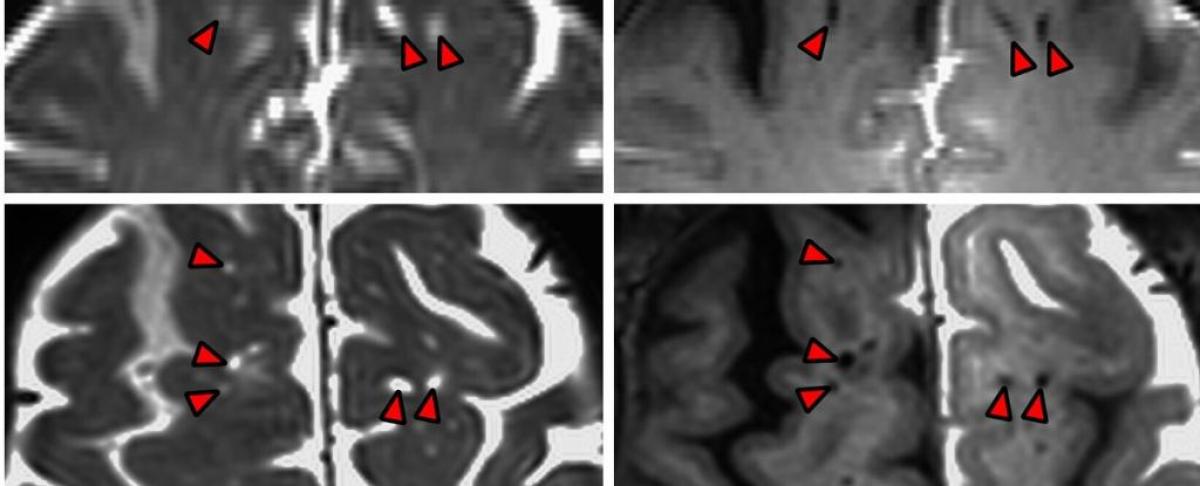 Фото PNAS