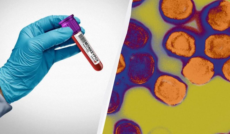 В Европе зафиксировали случай нового варианта mpox / коллаж УНИАН, фото фото ua.depositphotos.com В Европе зафиксировали случай нового варианта mpox / коллаж УНИАН, фото фото ua.depositphotos.com