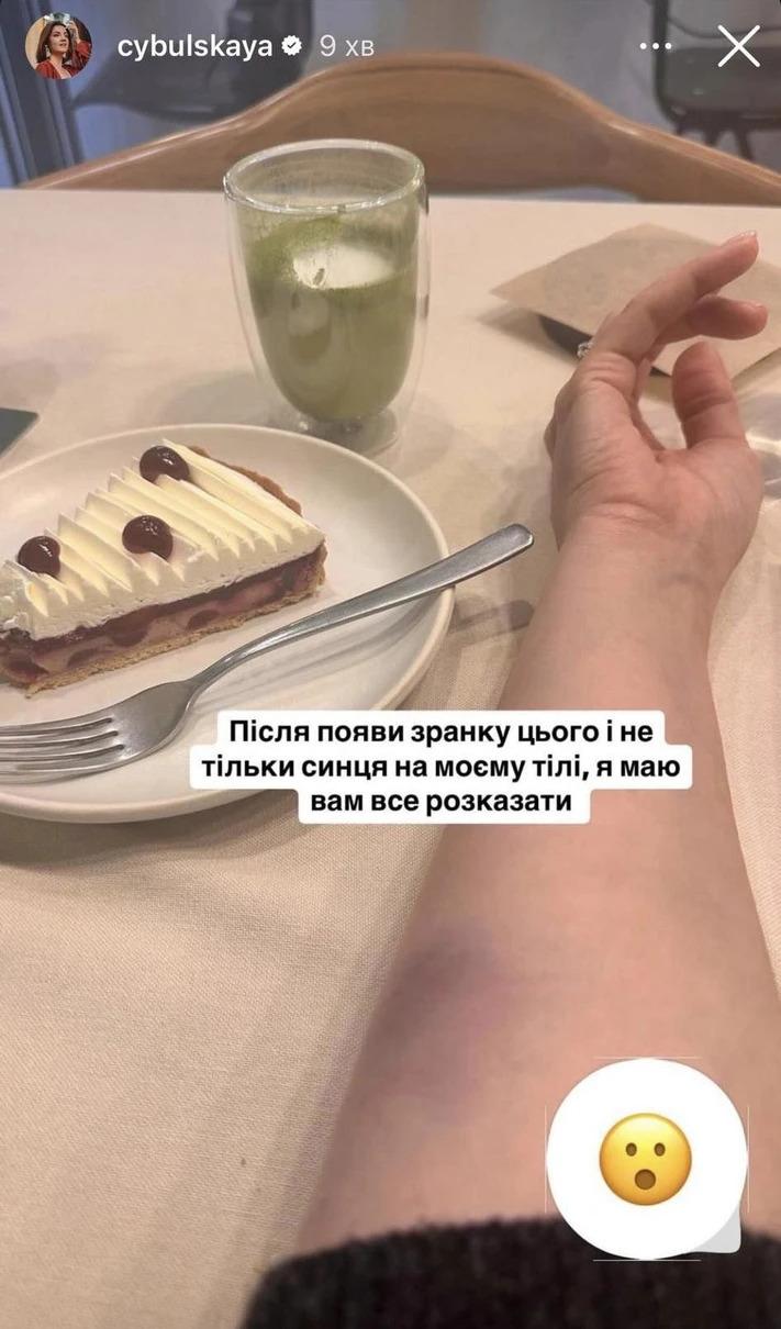 Співачка розповіла про інцидент / Скріншот Instagram Співачка розповіла про інцидент / Скріншот Instagram